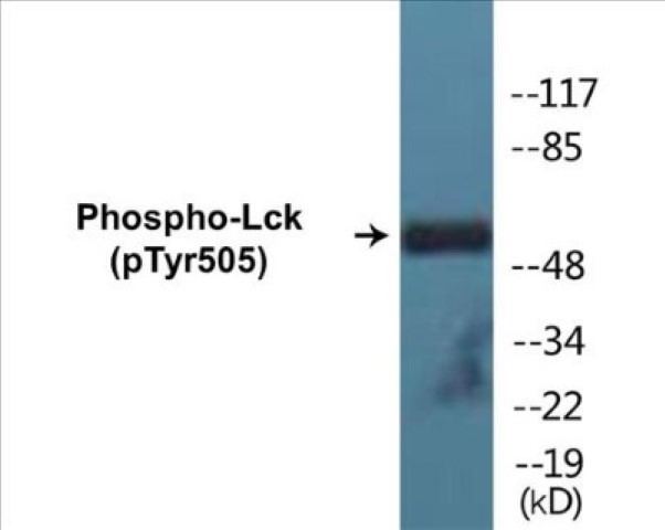 Lck (phospho Tyr505) Cell Based ELISA Kit