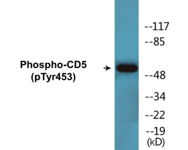 CD5 (phospho Tyr453) Cell Based ELISA Kit