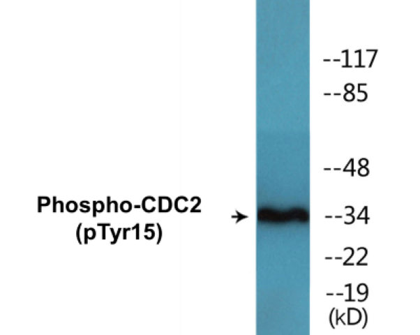 CDC2 (phospho Tyr15) Cell Based ELISA Kit