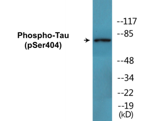 Tau (phospho Ser404) Cell Based ELISA Kit