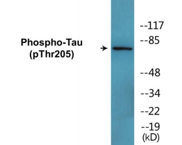 Tau (phospho Thr205) Cell Based ELISA Kit