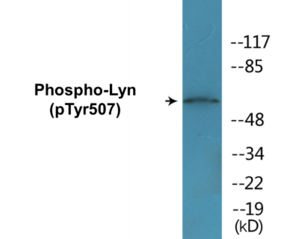 Lyn (phospho Tyr507) Cell Based ELISA Kit