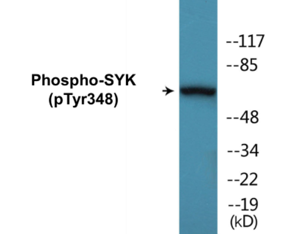 SYK (phospho Tyr348) Cell Based ELISA Kit
