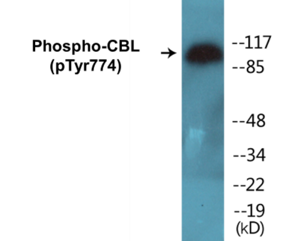 CBL (phospho Tyr774) Cell Based ELISA Kit