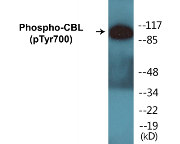 CBL (phospho Tyr700) Cell Based ELISA Kit