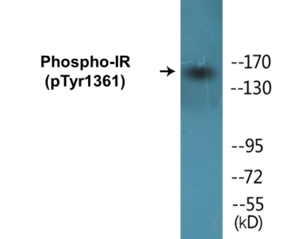 IR (phospho Tyr1361) Cell Based ELISA Kit