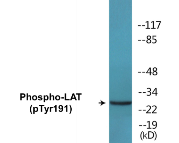 LAT (phospho Tyr191) Cell Based ELISA Kit