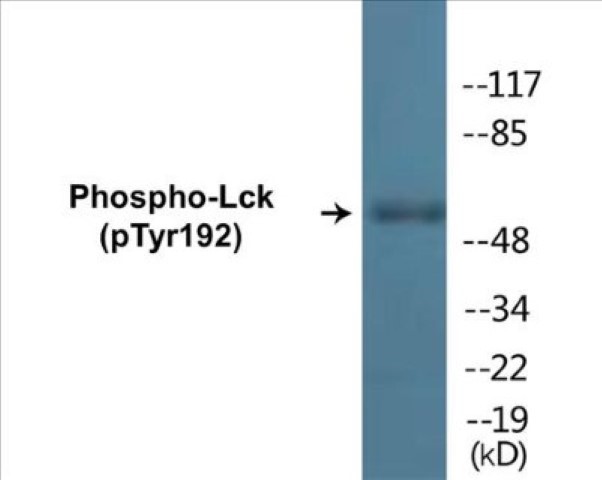 Lck (phospho Tyr192) Cell Based ELISA Kit