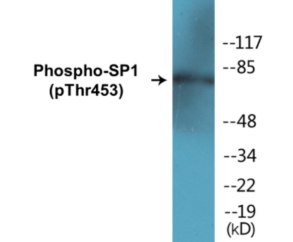 SP1 (phospho Thr453) Cell Based ELISA Kit
