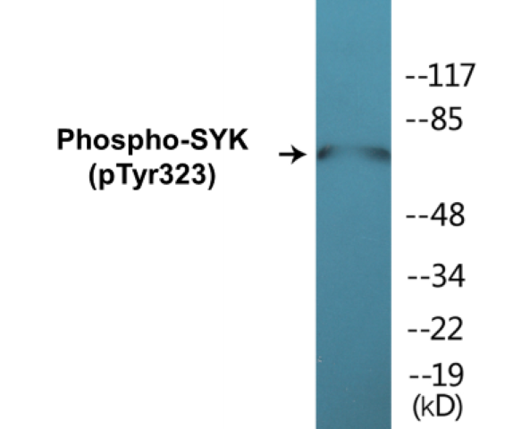 SYK (phospho Tyr323) Cell Based ELISA Kit