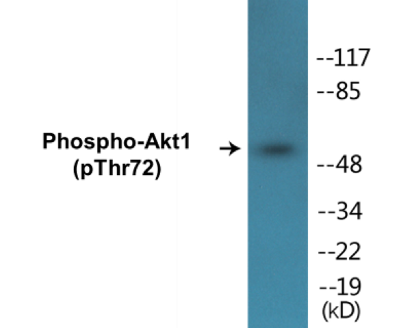 Akt1 (phospho Thr72) Cell Based ELISA Kit