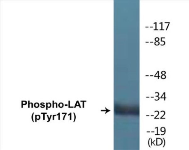 LAT (phospho Tyr171) Cell Based ELISA Kit
