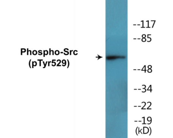 Src (phospho Tyr529) Cell Based ELISA Kit