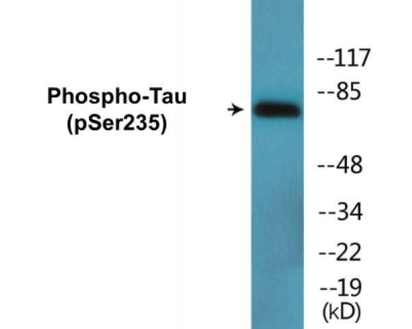 Tau (phospho Ser235) Cell Based ELISA Kit