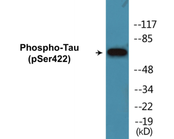 Tau (phospho Ser422) Cell Based ELISA Kit