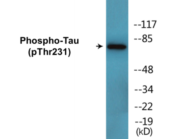 Tau (phospho Thr231) Cell Based ELISA Kit