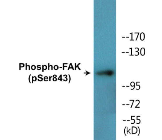 FAK (phospho Ser843) Cell Based ELISA Kit