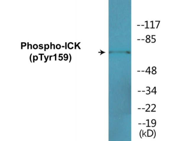ICK (phospho Tyr159) Cell Based ELISA Kit
