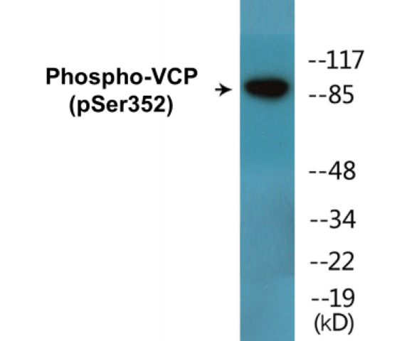 VCP (phospho Ser352) Cell Based ELISA Kit