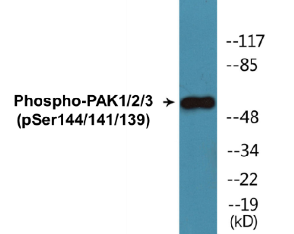 PAK1 + 2 + 3 (phospho Ser144 + Ser141 + Ser139) Cell Based ELISA Kit