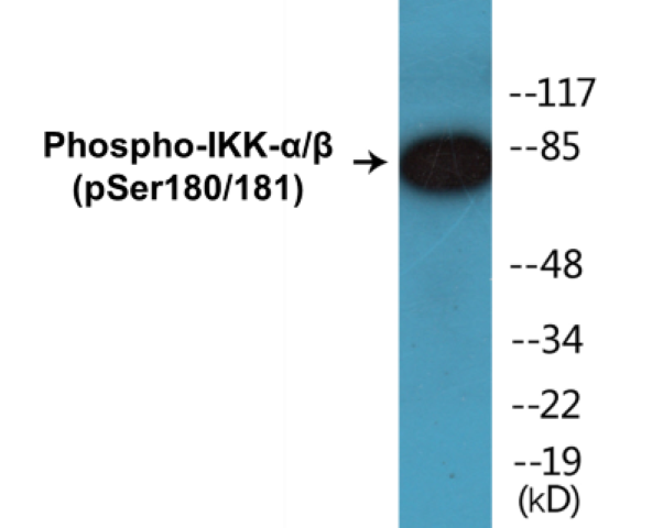 IKK alpha + beta (phospho Ser180 + Ser181) Cell Based ELISA Kit