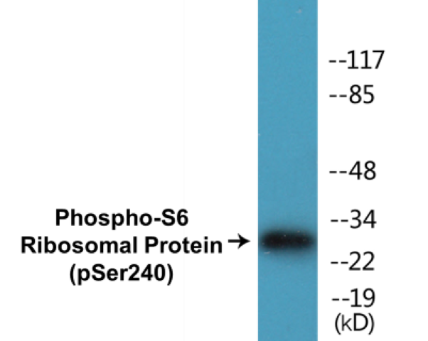 S6 Ribosomal Protein (phospho Ser240) Cell Based ELISA Kit