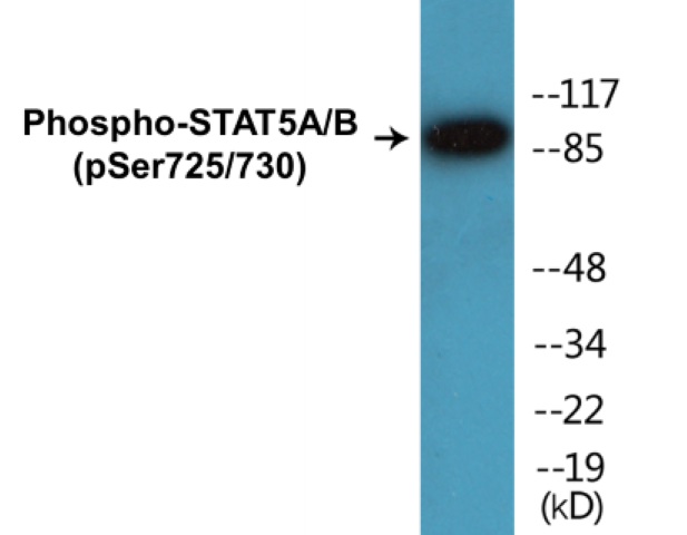 STAT5A + B (phospho Ser725 + Ser730) Cell Based ELISA Kit