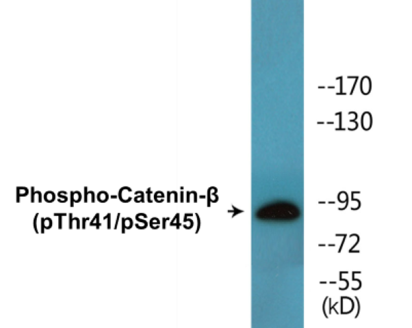 beta Catenin (phospho Thr41 + Ser45) Cell Based ELISA Kit