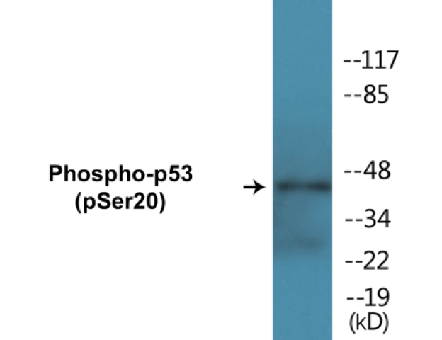 p53 (phospho Ser20) Cell Based ELISA Kit
