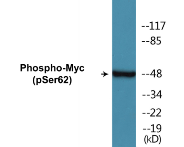 Myc (phospho Ser62) Cell Based ELISA Kit