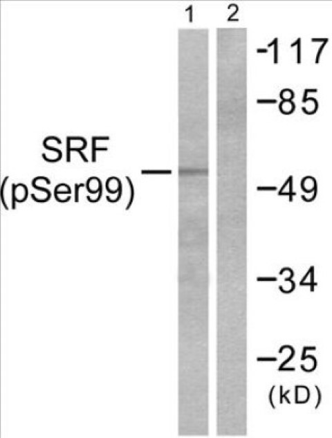 SRF (phospho Ser99) Cell Based ELISA Kit