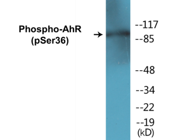 AhR (phospho Ser36) Cell Based ELISA Kit