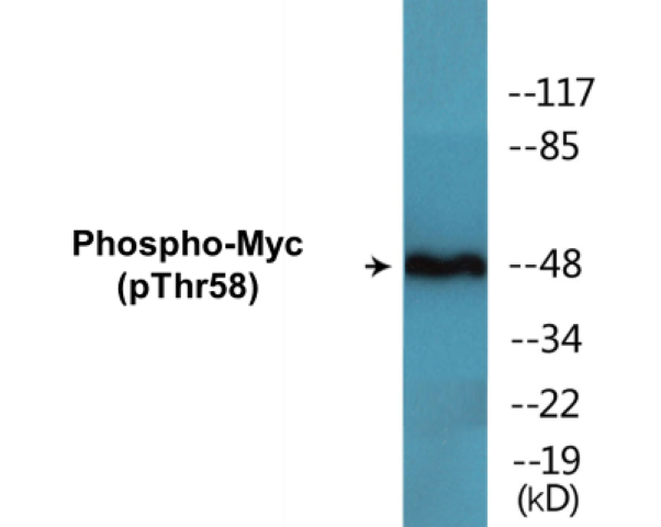 Myc (phospho Thr58) Cell Based ELISA Kit
