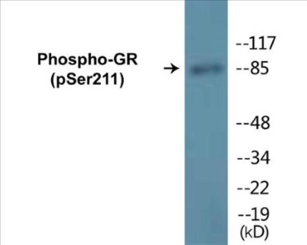 GR (phospho Ser211) Cell Based ELISA Kit