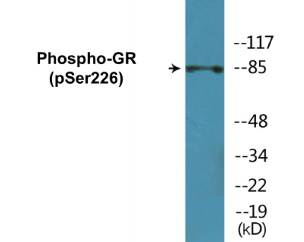 GR (phospho Ser226) Cell Based ELISA Kit