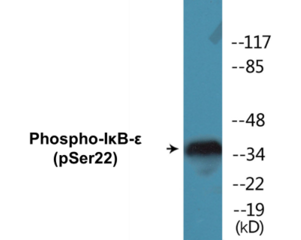 IkB epilson (phospho Ser22) Cell Based ELISA Kit