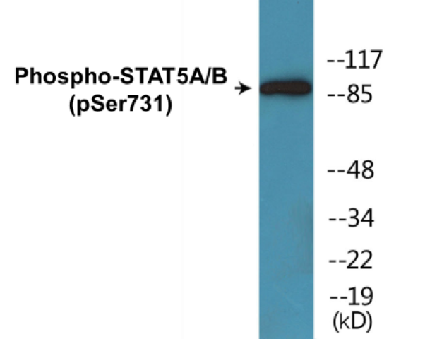 STAT5A + B (phospho Ser731) Cell Based ELISA Kit