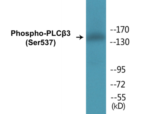 PLC beta 3 (phospho Ser537) Cell Based ELISA Kit