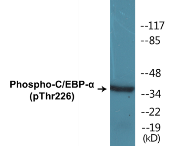 CEBP alpha (phospho Thr226) Cell Based ELISA Kit