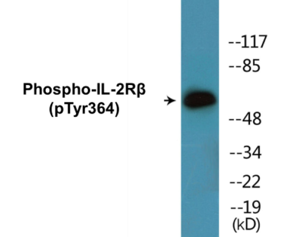 IL-2R beta (phospho Tyr364) Cell Based ELISA Kit