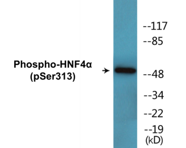 HNF4 alpha (phospho Ser313) Cell Based ELISA Kit