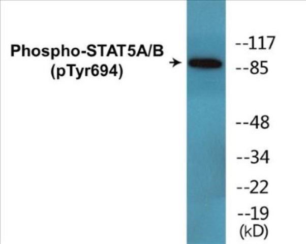 STAT5A + B (phospho Tyr694) Cell Based ELISA Kit