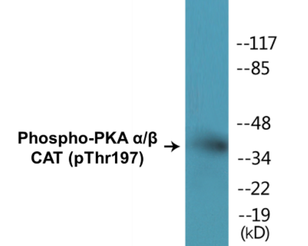 PKA alpha + beta (catalytic subunits) (phospho Thr197) Cell Based ELISA Kit