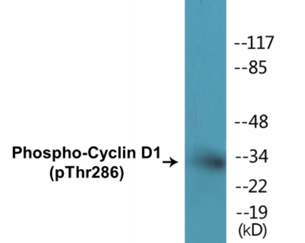 Cyclin D1 (phospho Thr286) Cell Based ELISA Kit