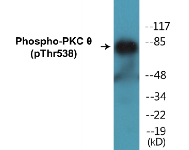 PKC theta (phospho Thr538) Cell Based ELISA Kit
