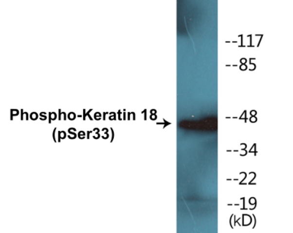 Keratin 18 (phospho Ser33) Cell Based ELISA Kit