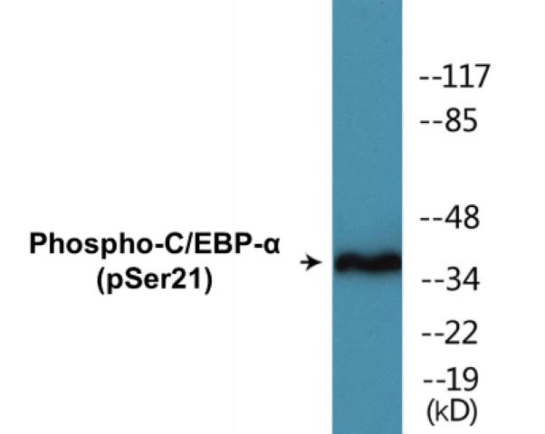 CEBP alpha (phospho Ser21) Cell Based ELISA Kit