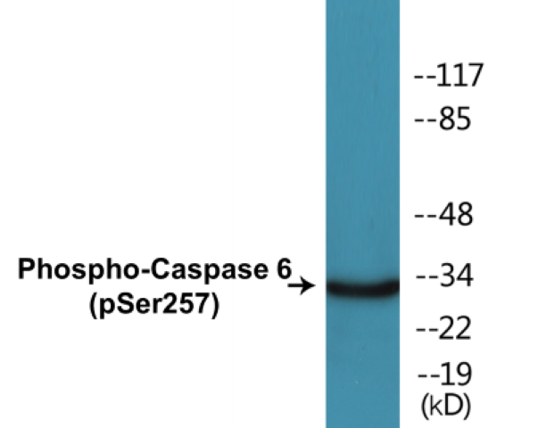 Caspase 6 (phospho Ser257) Cell Based ELISA Kit