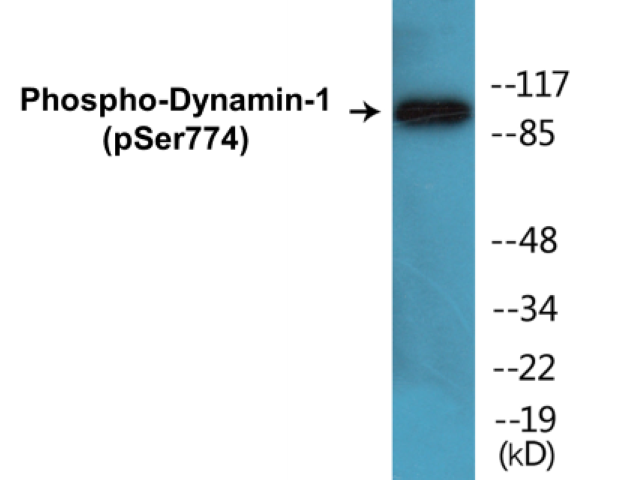 Dynamin-1 (phospho Ser774) Cell Based ELISA Kit