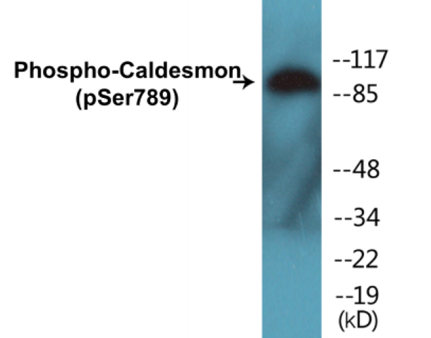 Caldesmon (phospho Ser789) Cell Based ELISA Kit